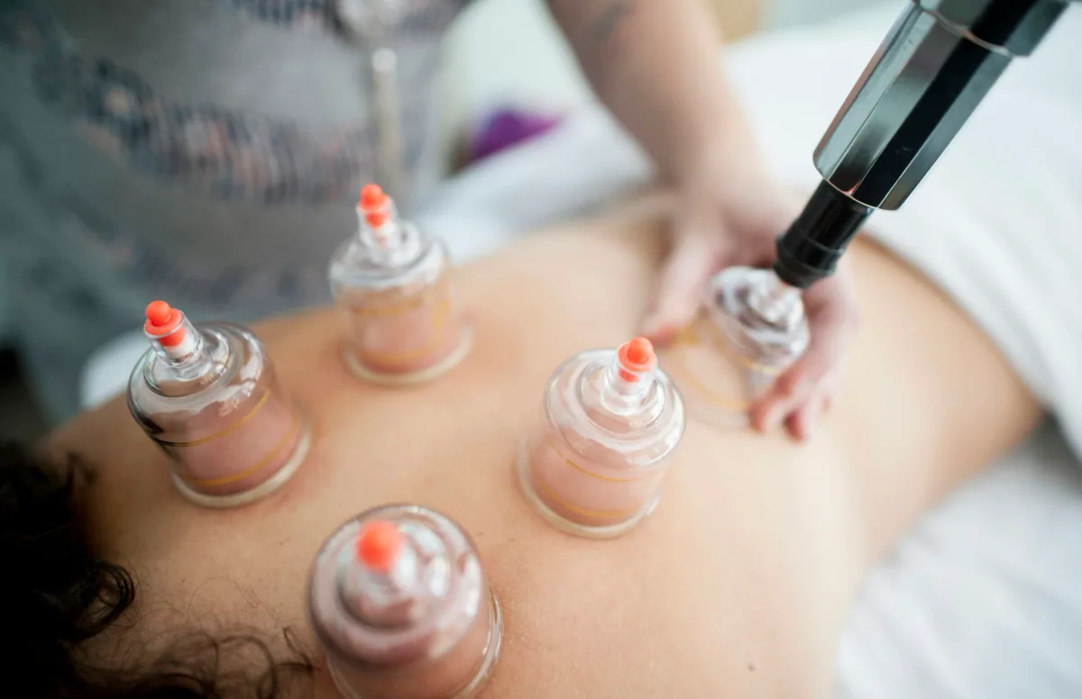Cupping therapy treatment at Maison Forest Spa